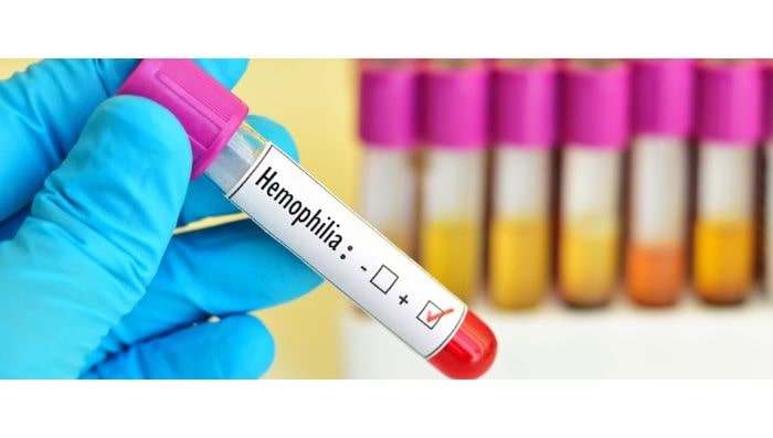 Hemofili hastaları kovid-19 aşısına dikkat!