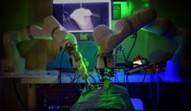 İnsan yardımı olmadan robotlar ameliyat yapabiliyor